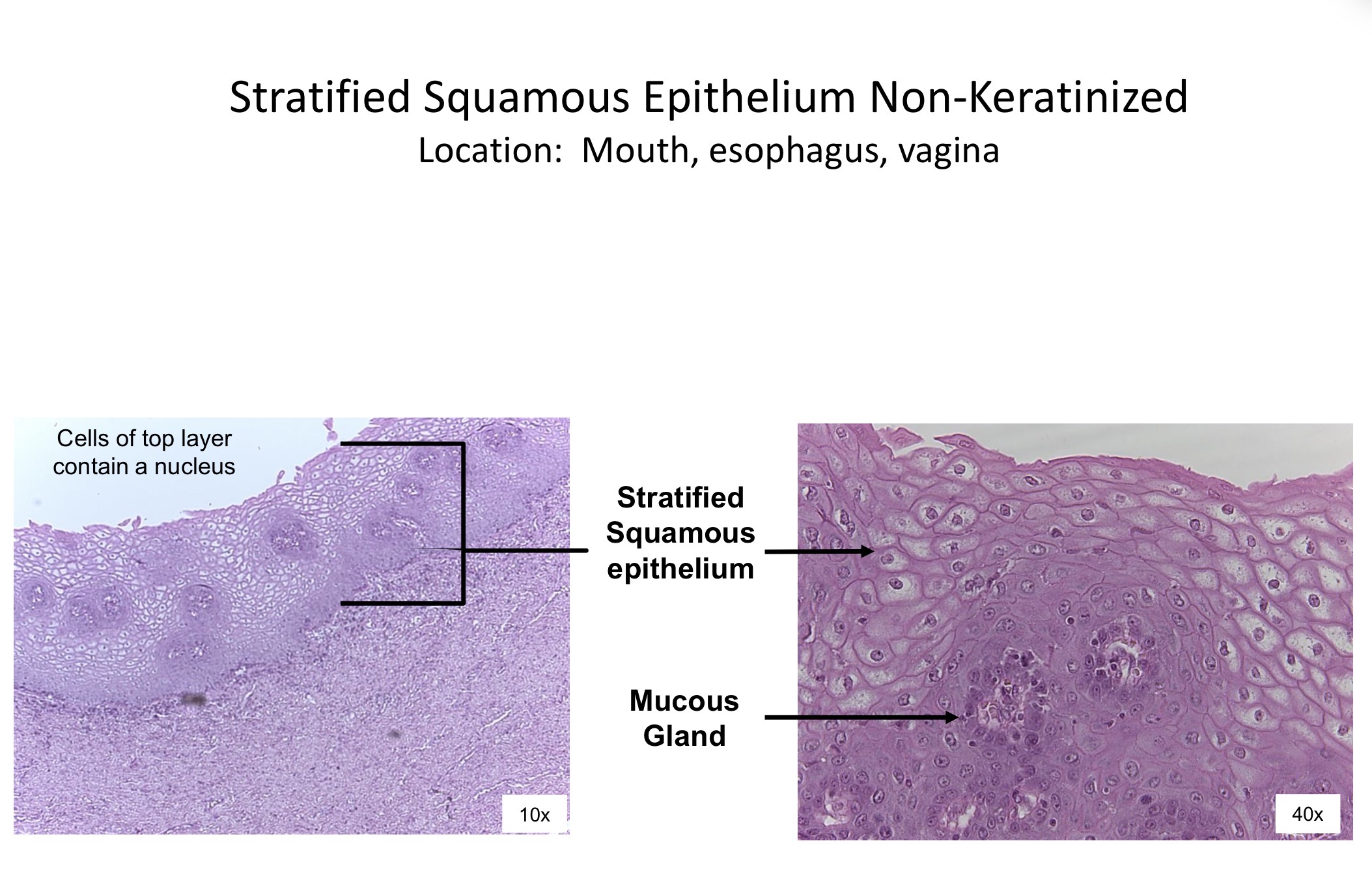 <ol><li><p>Stratified squamous epithelium </p></li><li><p>Mucous gland</p></li></ol><p></p>