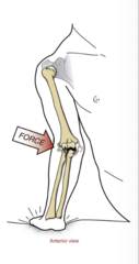 <p>anterior </p><p>humeroradial</p><p>radial</p>