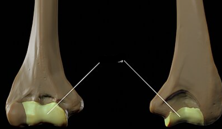 <p>What bone landmark is this within the <strong>Humerus </strong></p>