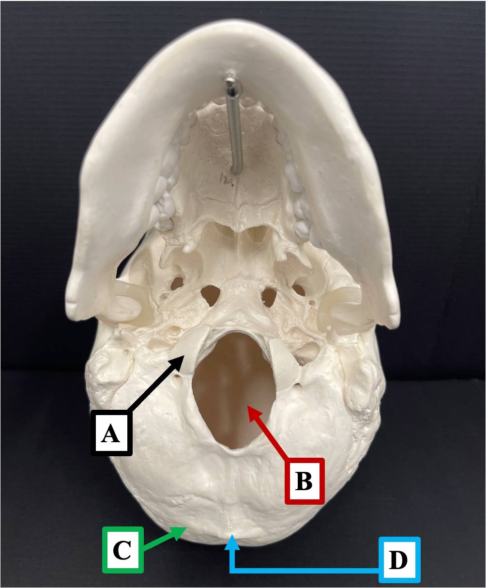 <p>Identify the name of the bony landmark that label <strong>A </strong>is pointing to.</p>