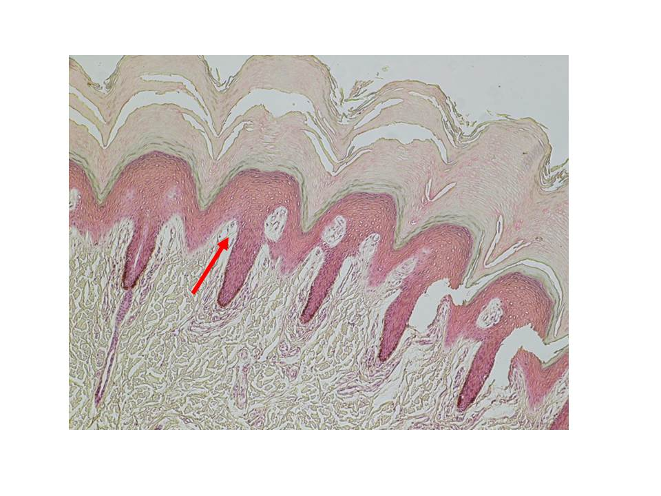 term image