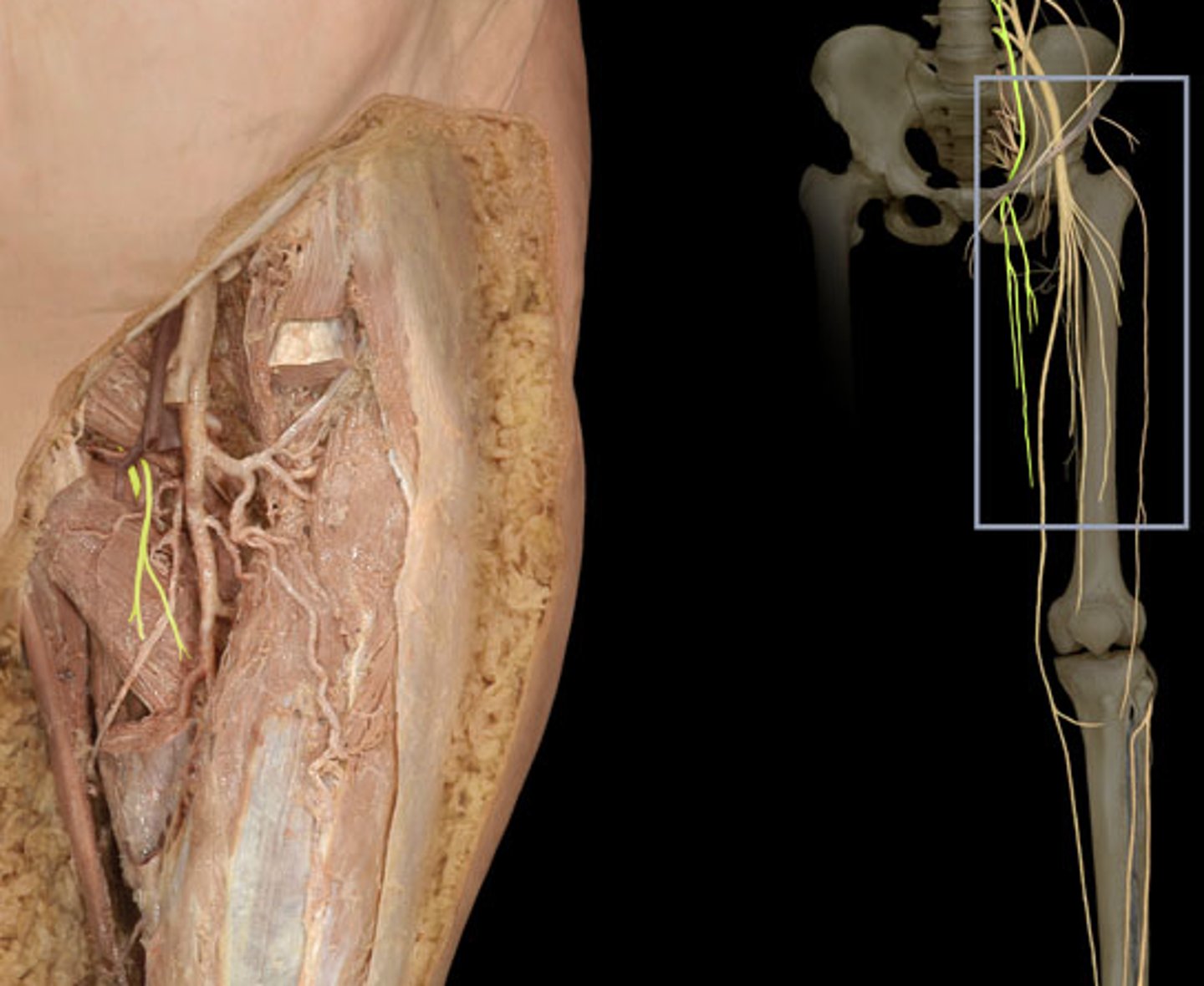 <p>-L2-L4</p><p>-Lumbar plexus</p><p>-innervates inner thigh adductor medially</p>