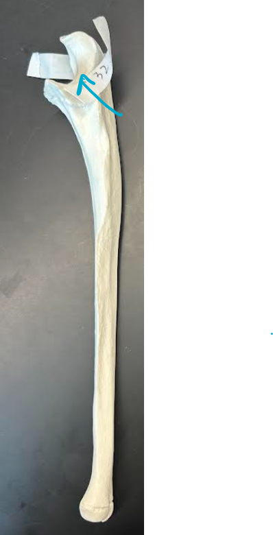 <p>ID ulna region </p>
