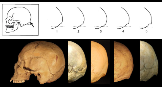 <p>Nuchal Crest - Cranial</p>