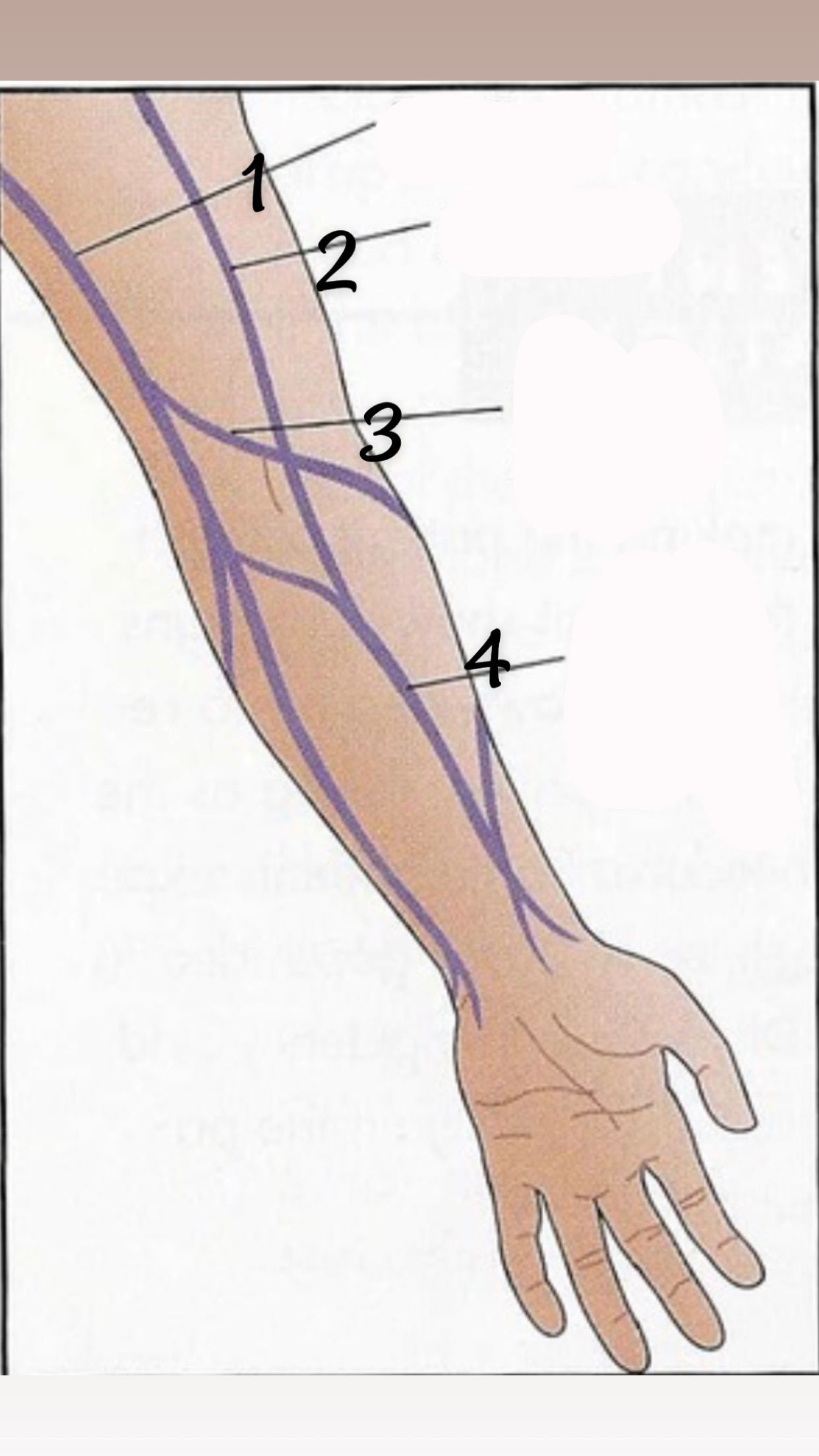 <p>spot 4</p>