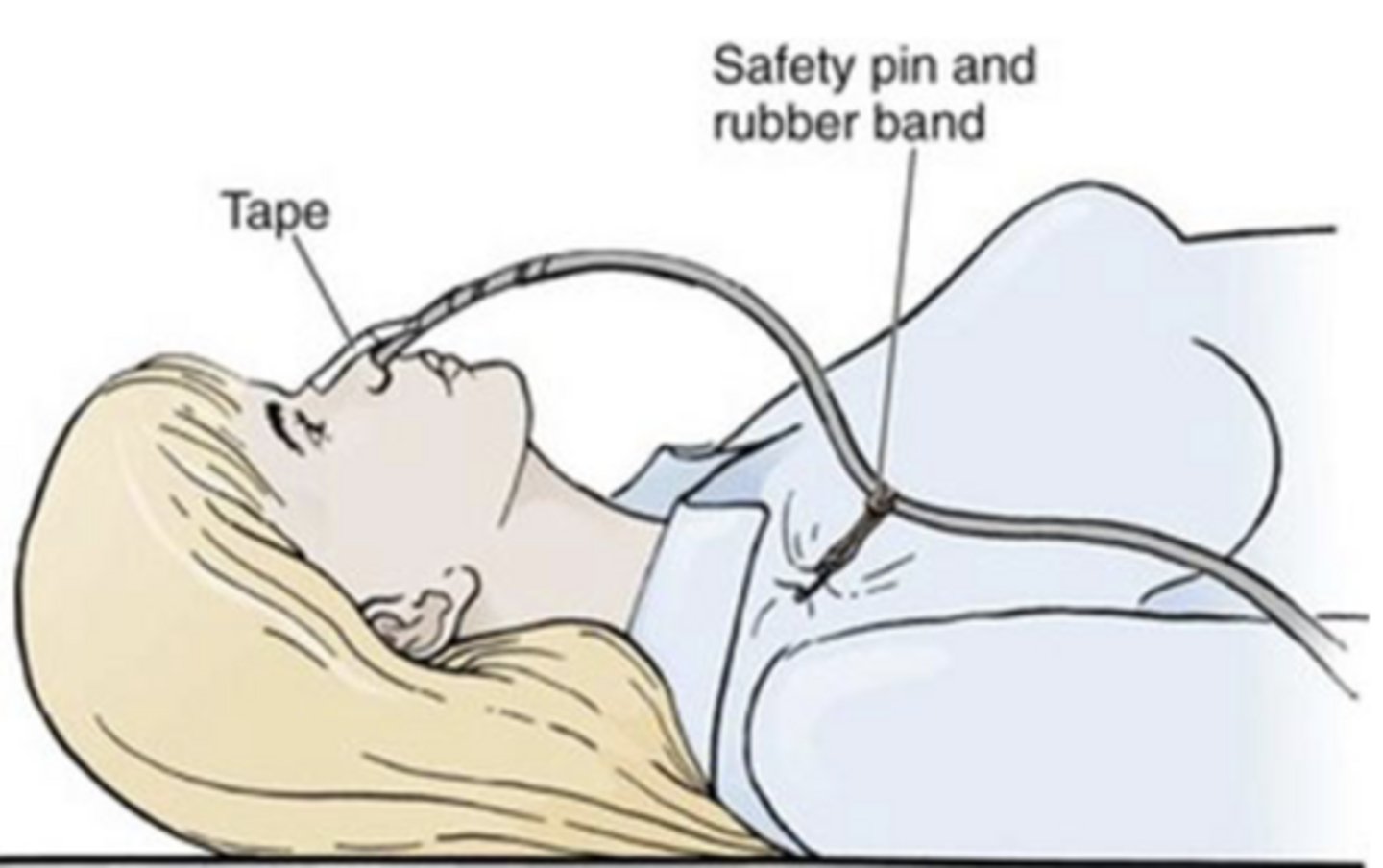 <p>avoid tension on line</p><p>pin tube to clothing</p><p>GENTLY brush tube out of xray field</p><p>report to RN if concerned placement is incorrect</p>