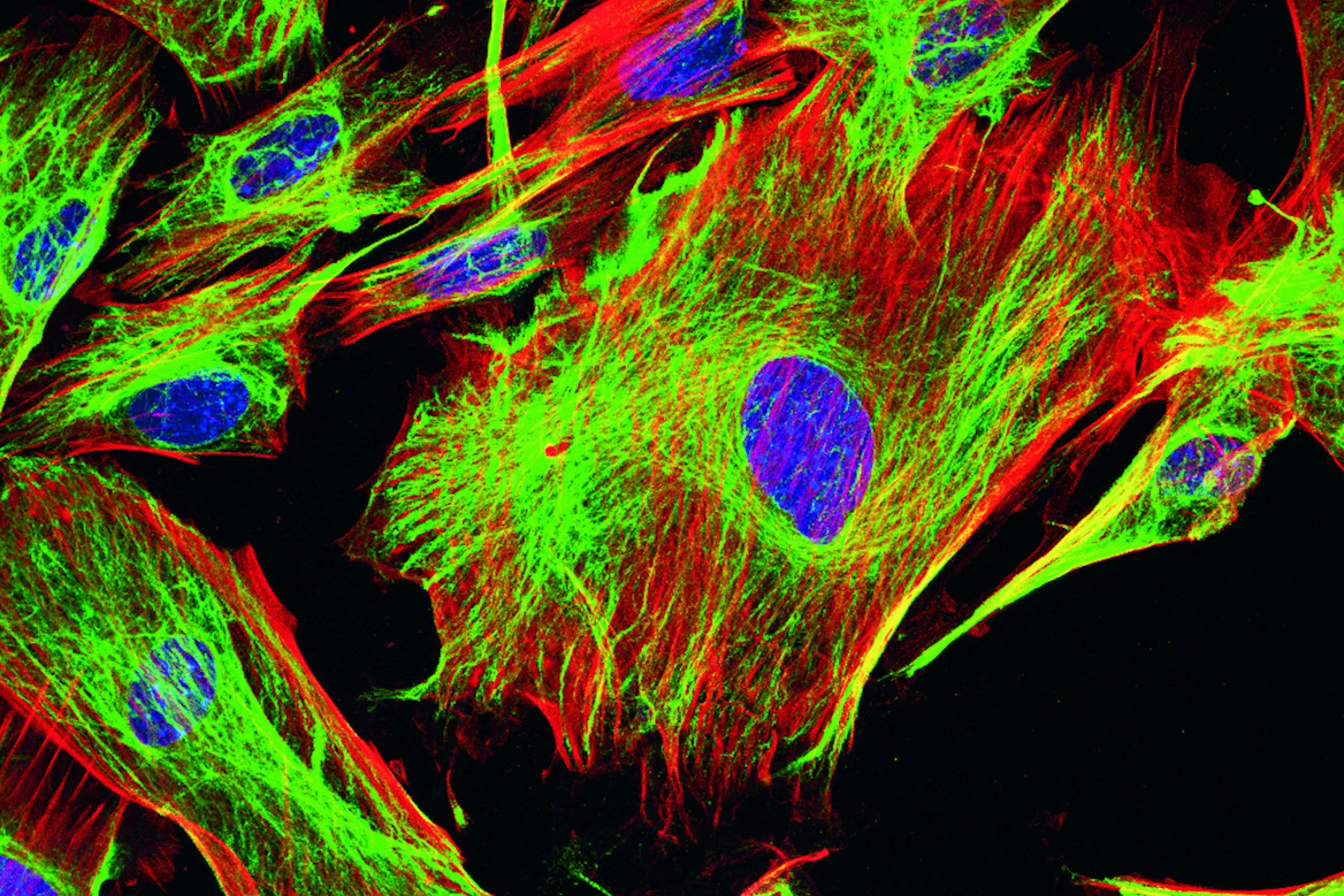 <p>describe fluorescent contrast </p>