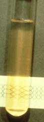 <p>Describe this joint fluid</p>