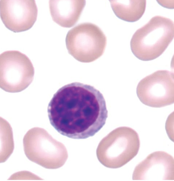 <p>What WBC is this?</p>