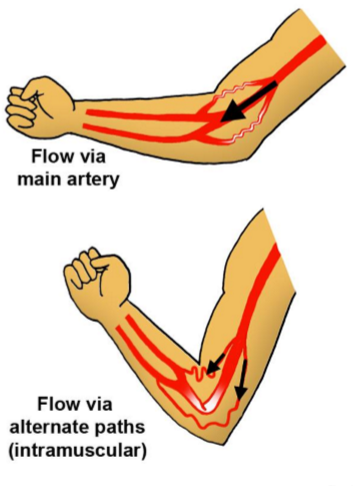 <p>Links b/w arteries or b/w arterioles</p><ul><li><p>Provide potential detours for blood flow (collateral flow) if usual pathway is obstructed</p></li><li><p>Adjacent arteries tend to anastomose</p></li><li><p>Occur around joints, are significant only in muscle belly that crosses the joint</p></li></ul><p></p>