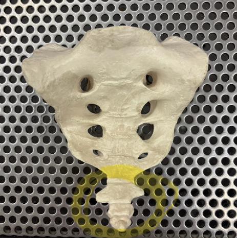 <p>What bone is circled in yellow?</p>