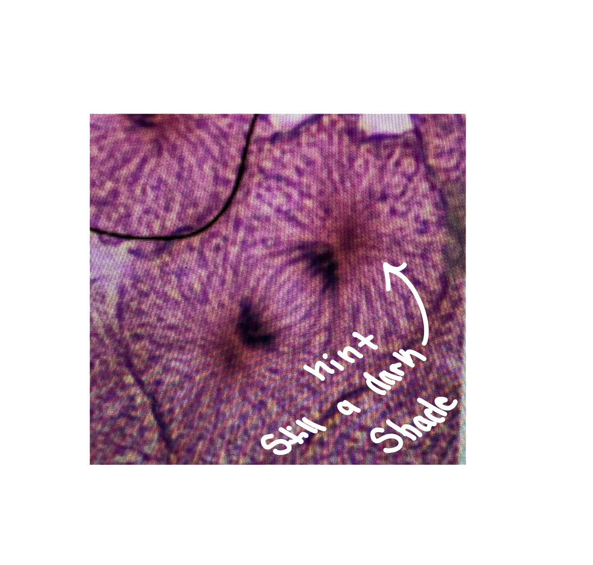 <p>What phase of mitosis is this?</p>