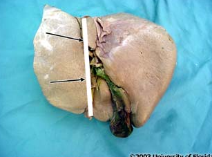 <p>what liver fissure on the VISCERAL surface of the liver is being highlighted?</p>