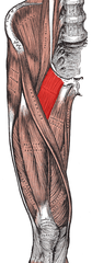 <p>pectineal line of pubis</p>