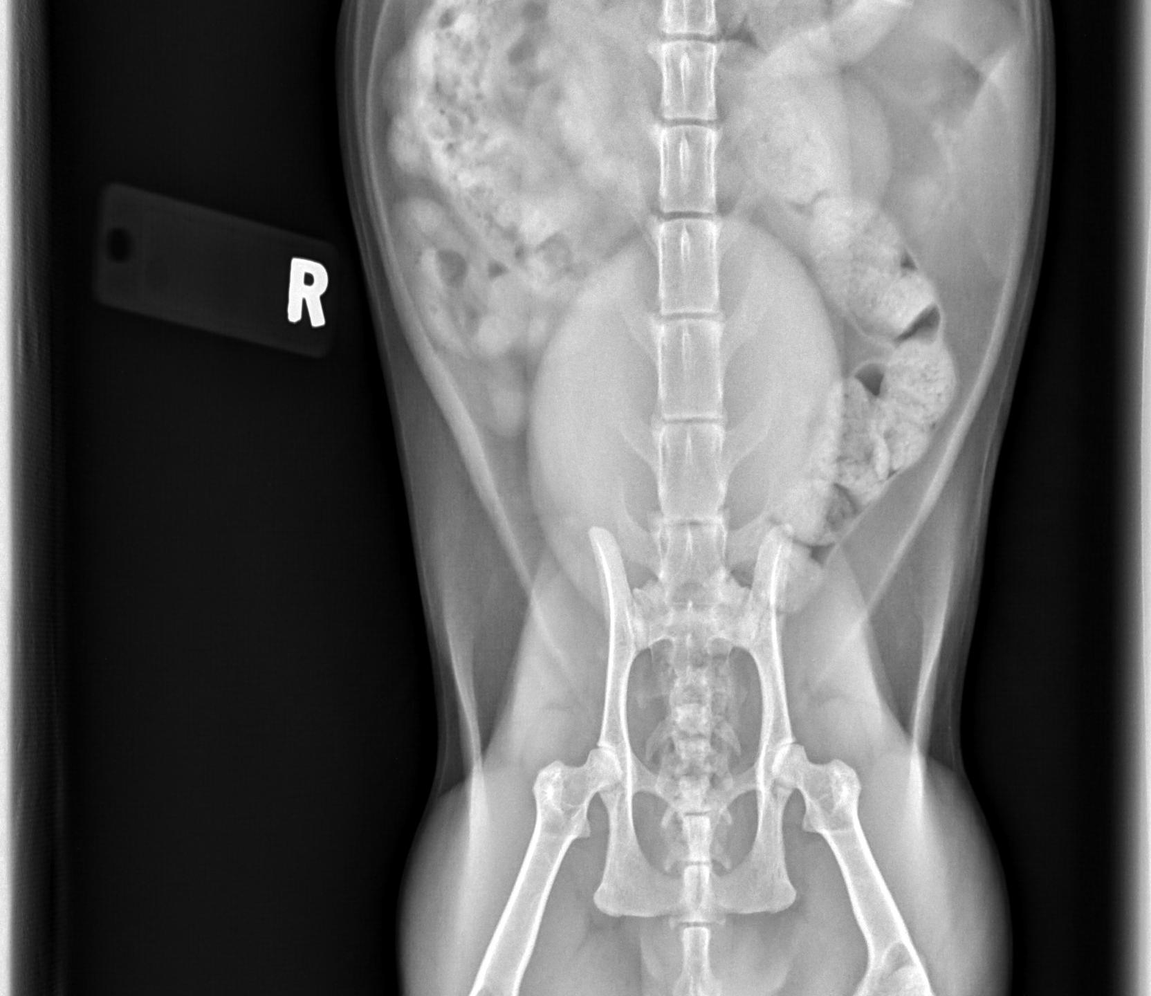 <p>The urinary bladder is seen where in this image</p>