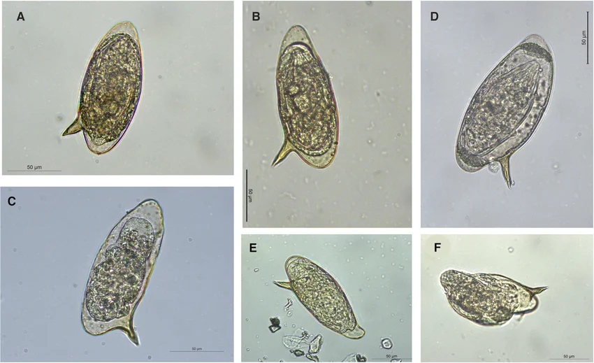 <p>Schistosomiasis</p>