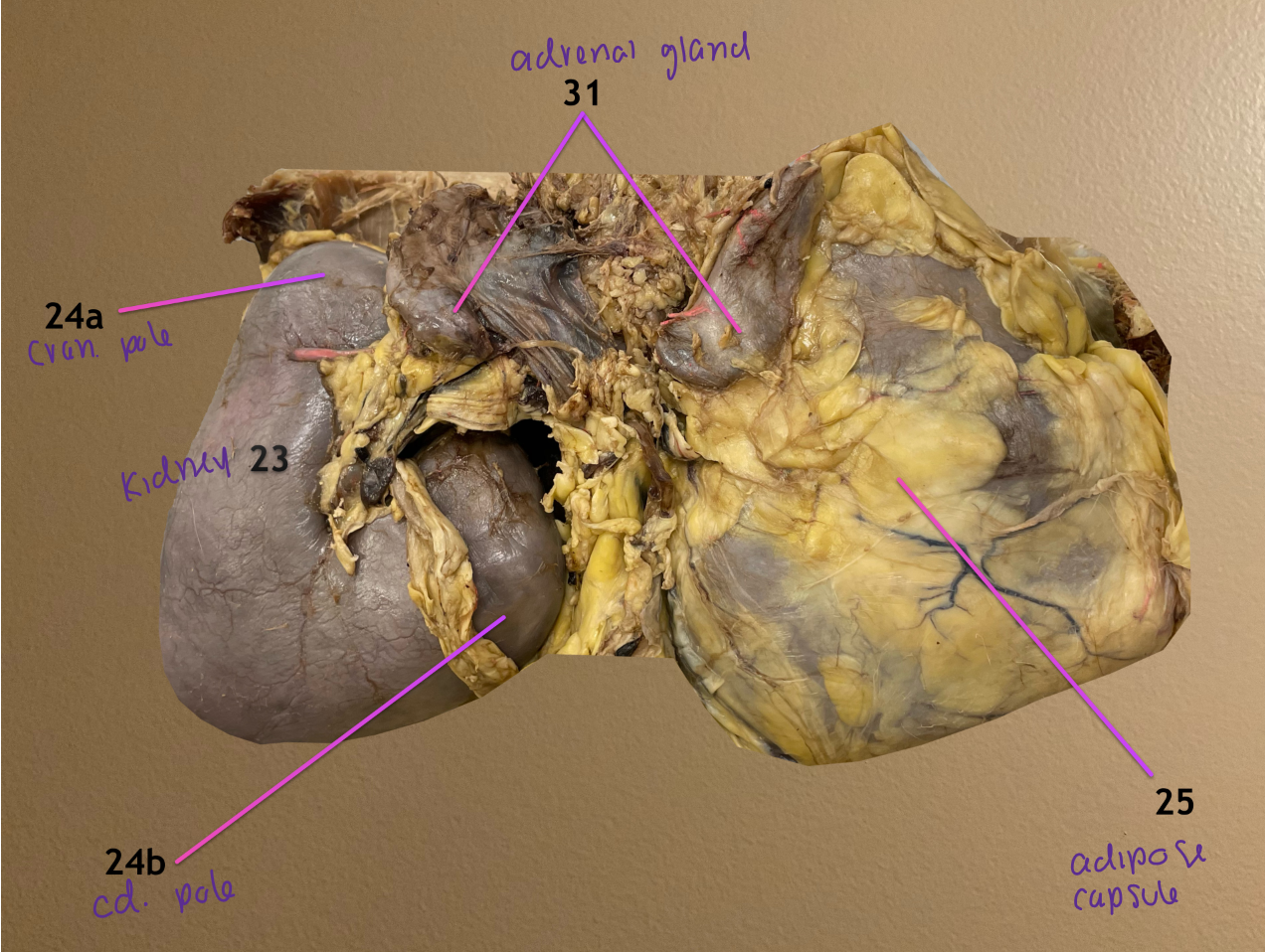 <ol start="23"><li><p>kidney</p></li></ol><p>24a: cranial pole of kidney</p><p>24b: caudal pole of kidney</p><ol start="25"><li><p>adipose capsule</p></li></ol><ol start="31"><li><p>adrenal gland: medial to each kidney</p></li></ol><p></p>