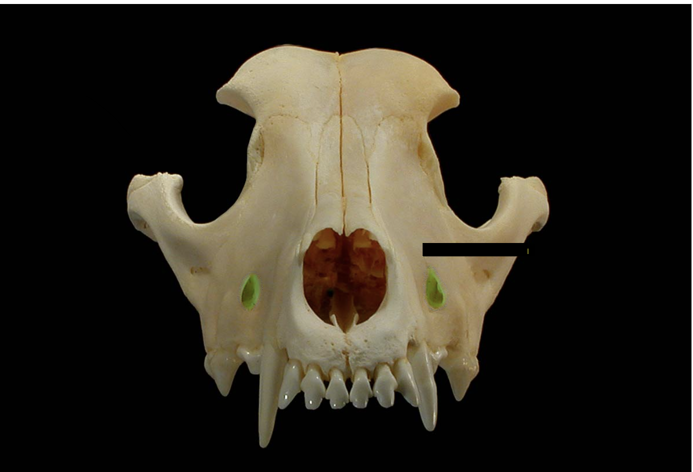 <p>what foramen is on the maxilla and nerve </p>