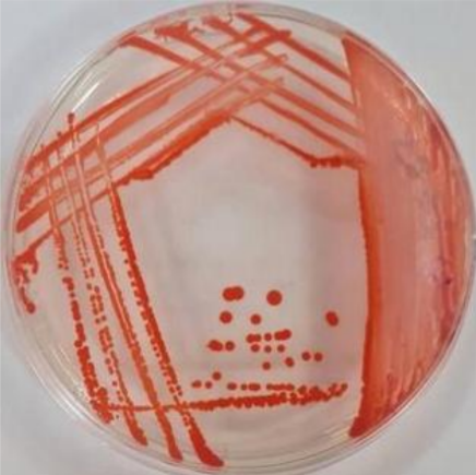 <p>Red pigmentation when grown at 20-30C is what pathogen </p>