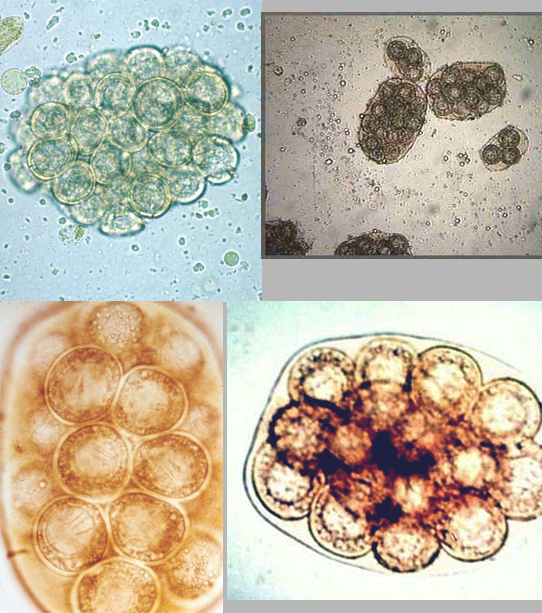 <p>Eggs are the stage consumed by IH - Flea or louse</p>