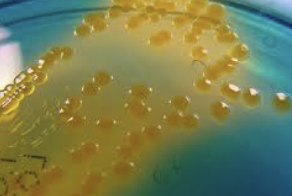 <p>which species of vibrio are acidic on TCBS (yellow)?</p>