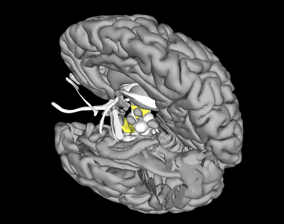 <p>What area of the brain is this</p>