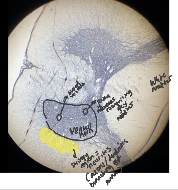 <p>large horn = ventral horn </p><p>circles = blood vessels </p><p>stringy region = neurites </p><p>white matter = myelinated axons</p><p>dots = soma of neurones comprising of grey matter </p>