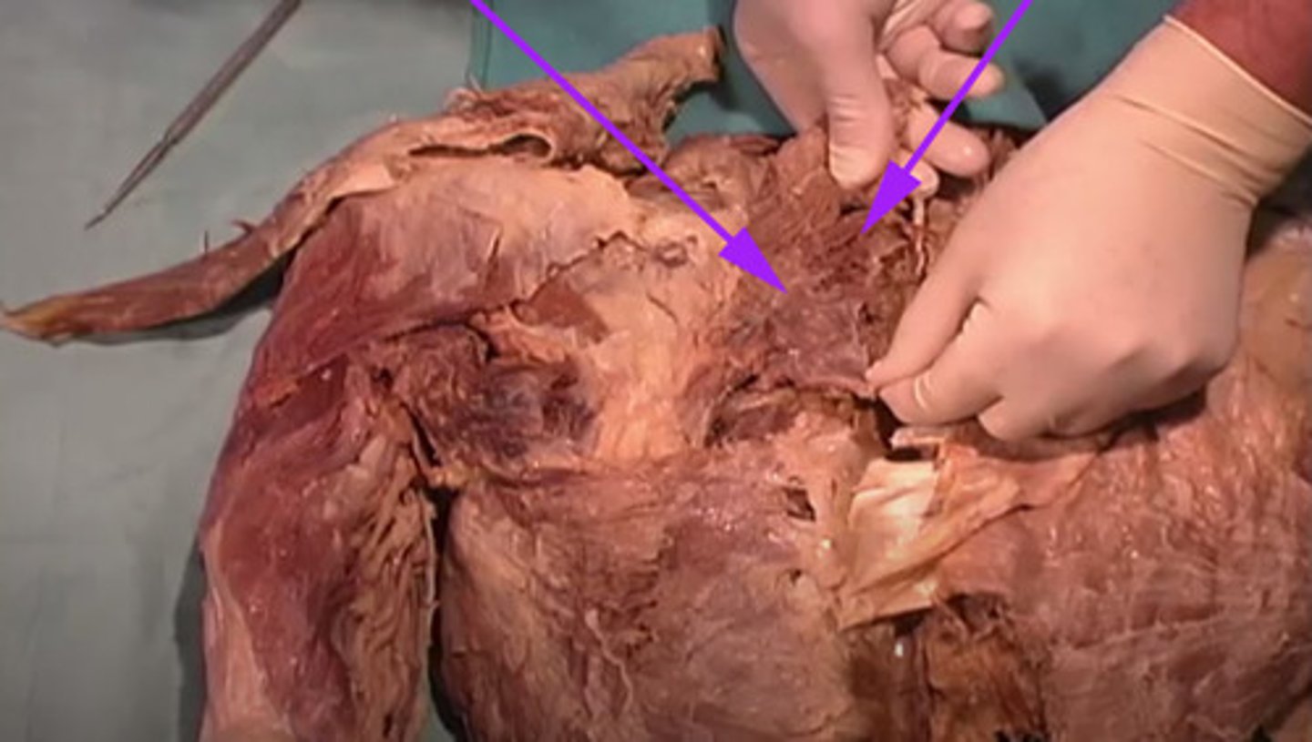 <p>What is the name of this muscle as indicated by the arrows?</p>