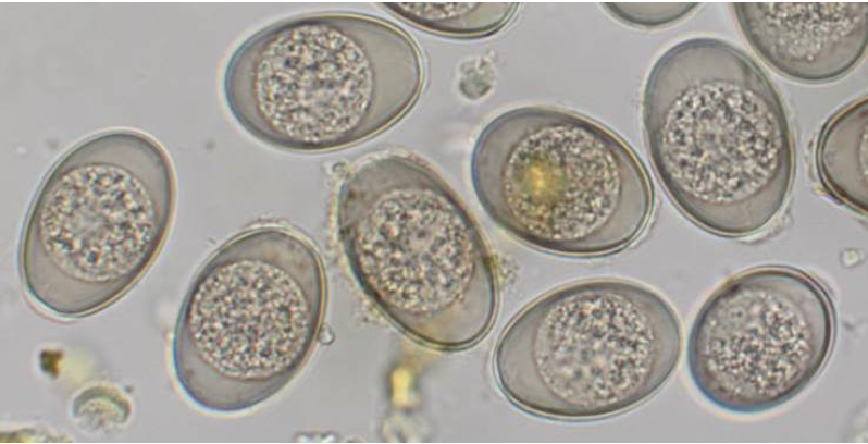 <p>fecal of a 15 week old calf</p>