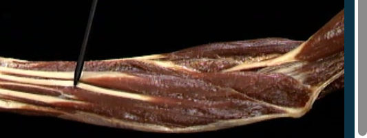 <p>Onder arm, anterior zicht</p>