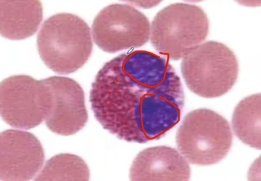 <ul><li><p><span>The number in the blood is normally quite low (0-450/ul).</span></p></li><li><p><span>﻿﻿Their numbers increase sharply in certain diseases, especially infections by parasitic worms.</span></p></li><li><p><span>﻿﻿They are cytotoxic, releasing the contents of their granules on the invader.</span></p></li></ul><p></p>