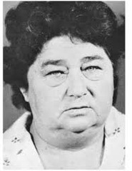 <p>Puffy face, periorbital edema, coarse features, dry skin.</p>
