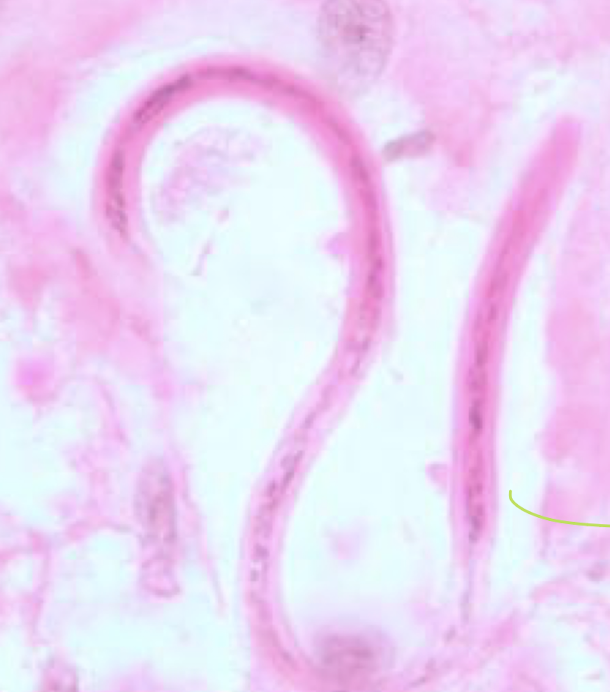 <p>which parasite is this?</p>