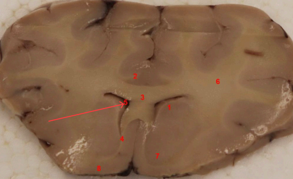 <p>what ventricle is this </p>