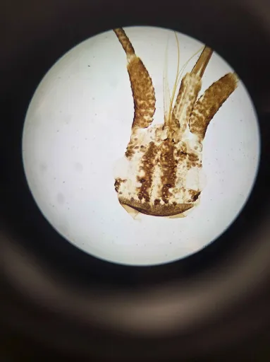 <p>What order individual is this head from? What are the two string like structures?</p>
