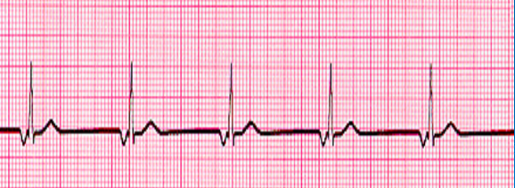 <p>what waveform is this </p>