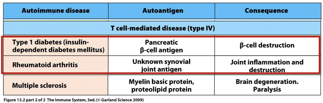 <p>Caused by T cell responses that destroy insulin producing pancreatic cells (NO INSULIN PRODUCED AT ALL → unlike type 2)</p>