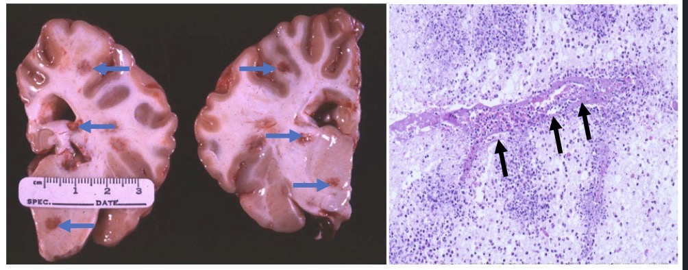 <p>Tissue from a cow. What’s wrong? Pathogenesis?</p>