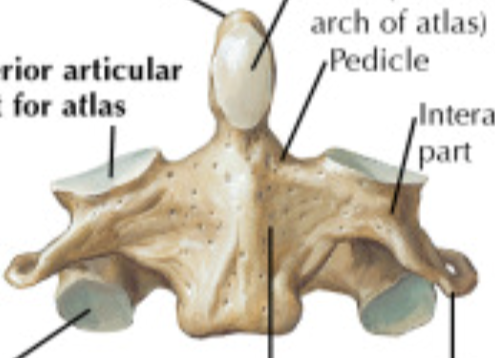 <p>what part of the vertebral column is this bone from and in what view?</p>