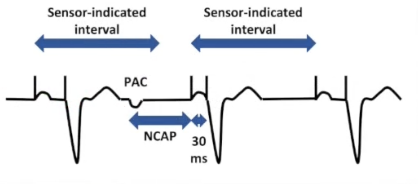 <p>Non-competitive atrial pacing</p><ul><li><p>Pacing in atrial vulnerable period can trigger atrial<br>tachyarrhythmia</p></li><li><p>NCAP delays time to next paced atrial event after PAC</p></li><li><p>Defines PAC as atrial signal inside PVARP</p></li><li><p>Extends NCAP window</p></li><li><p>Next AV interval shortened</p></li></ul><p></p>
