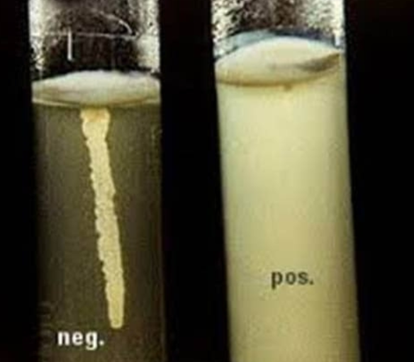 <p>Sulfide Indole <strong><u>Motility </u></strong>product</p>