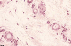 <p>identify the tissue</p>