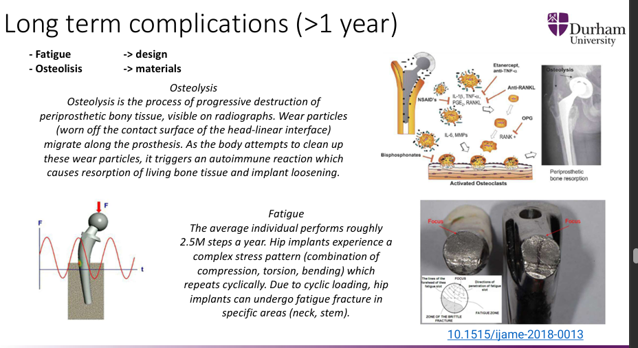 <p>Osteolysis is the process of progressive destruction of periprosthetic bony tissue, visible on radiographs. Wear particles (worn off the contact surface of the head-linear interface) migrate along the prosthesis. As the body attempts to clean up these wear particles, it triggers an autoimmune reaction which causes resorption of living bone tissue and implant loosening.</p>