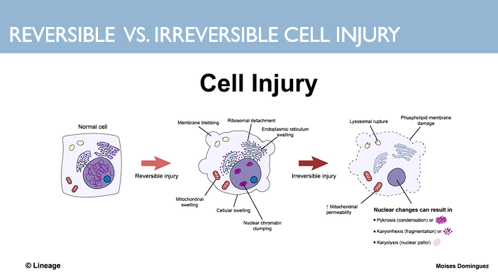 <ul><li><p>Stress is mild → moderate</p></li><li><p>injured cell may recover</p></li><li><p>caused by hypoxia, decreased ATP, sodium potassium pump failures, or failures of calcium channels</p></li><li><p>Result= <span style="color: red;">cellular swelling, Mitochondrial swelling, ER swelling → blebbing of those membranes</span></p></li><li><p><span style="color: rgb(255, 255, 255);">Ca enters cell→ ribosomal detachment→ decreased protein synthesis and alteration of lipids → clumping of chromatins</span></p></li><li><p><span style="color: rgb(255, 255, 255);">Leads to protein denaturation and </span><span style="color: red;">changes in the structure of DNA</span></p></li><li><p><span style="color: red;">Goes back into a state of homeostasis and becomes a normal cell</span></p></li></ul><p></p>