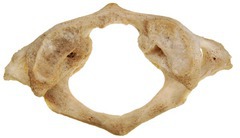 <p>Name of Bone and vertebrae</p>