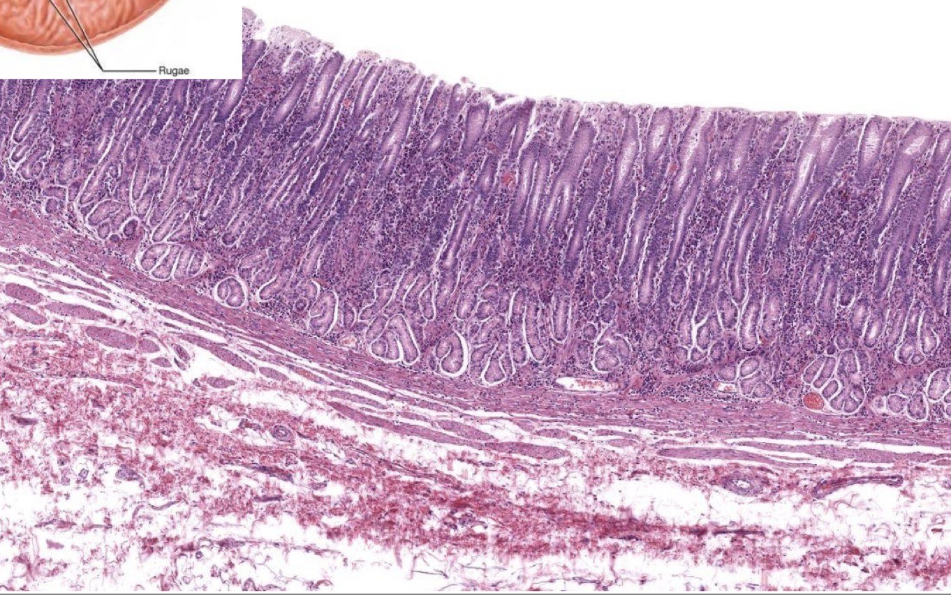 <p>What area of the stomach is this?</p>