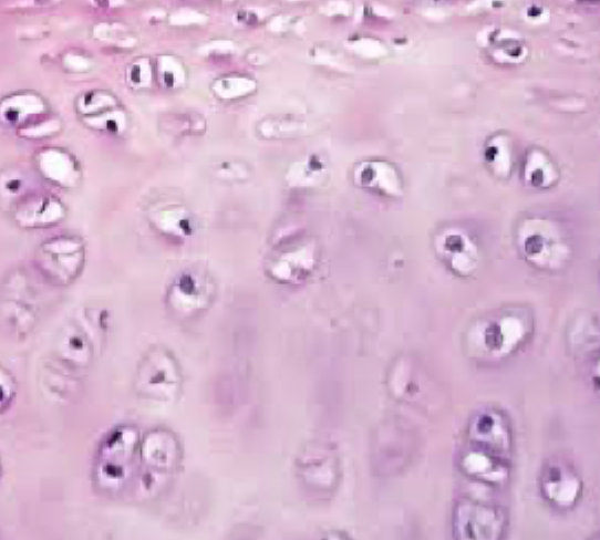 <p>Hvorfor kan brusk modstå tryk?</p>