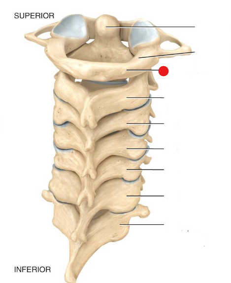 <p>Identify the structure pinned</p>