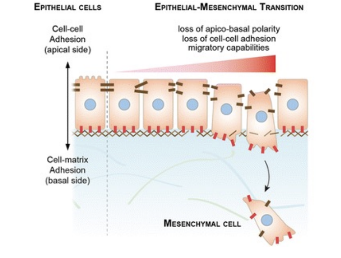 <p>complex, non-linear multi-step process that converts epithelial cells into mesenchymal cells</p>