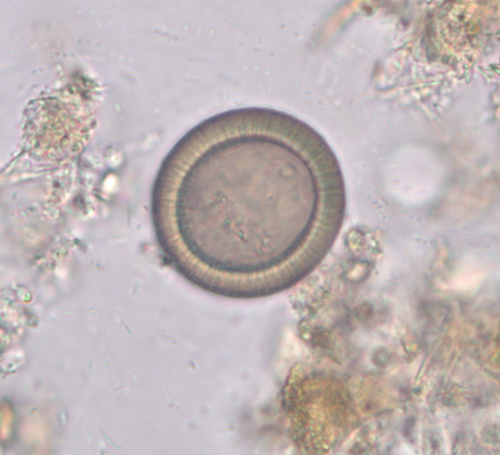 <p>characteristic radiating shell</p>